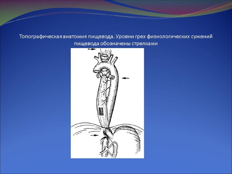 Топографическая анатомия пищевода. Уровни грех физиологических сужений пищевода обозначены стрелками